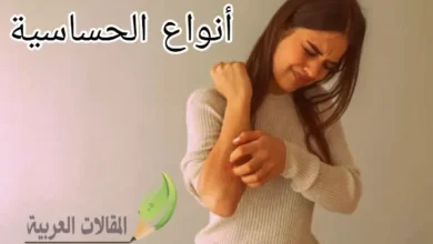 أنواع الحساسية