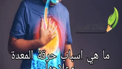 ما هي اسباب حرقة المعدة وعلاجها