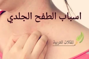 اسباب الطفح الجلدي