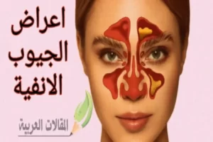 اعراض الجيوب الانفية