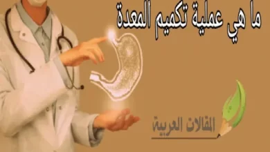 ما هي عملية تكميم المعدة