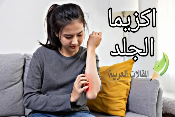 اكزيما الجلد