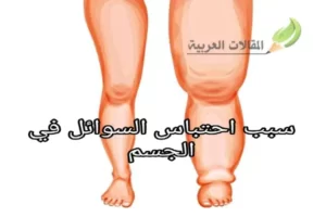 سبب احتباس السوائل في الجسم
