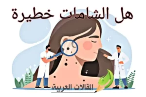 هل الشامات خطيرة