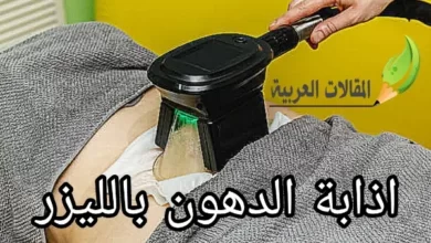 اذابة الدهون بالليزر