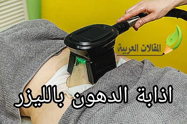 اذابة الدهون بالليزر