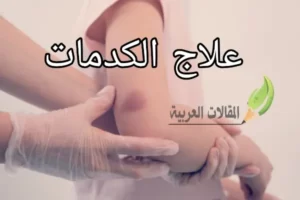 علاج الكدمات
