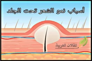 أسباب نمو الشعر تحت الجلد