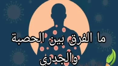 ما الفرق بين الحصبة والجدري