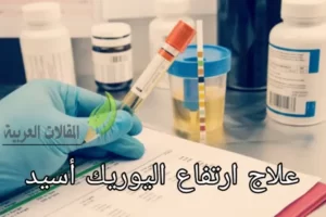 علاج ارتفاع اليوريك أسيد